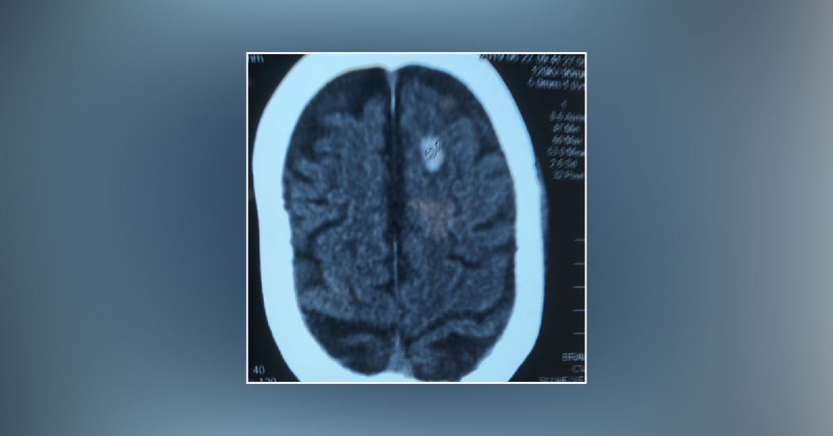 Need More Care In Reporting By Imaging Specialists In India