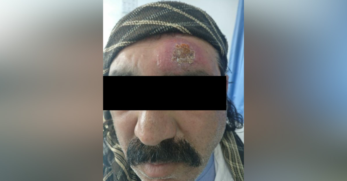 Interesting Dermatology Cases