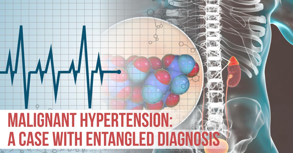 A 33 year old with hyperaldosteronism and hyperreninemia