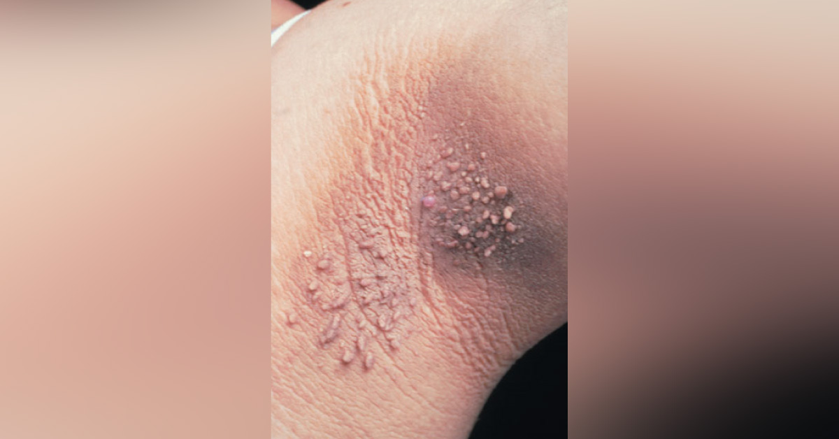 A Girl Stating Her Neck As ‘Dirty’