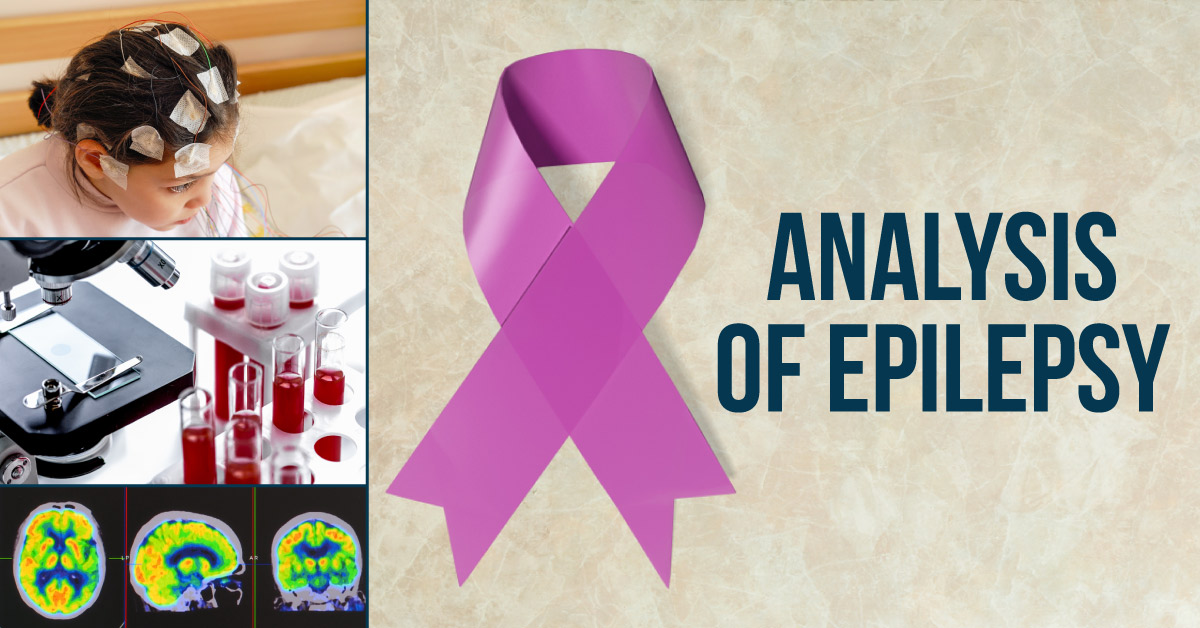 Diagnostic View of Epilepsy