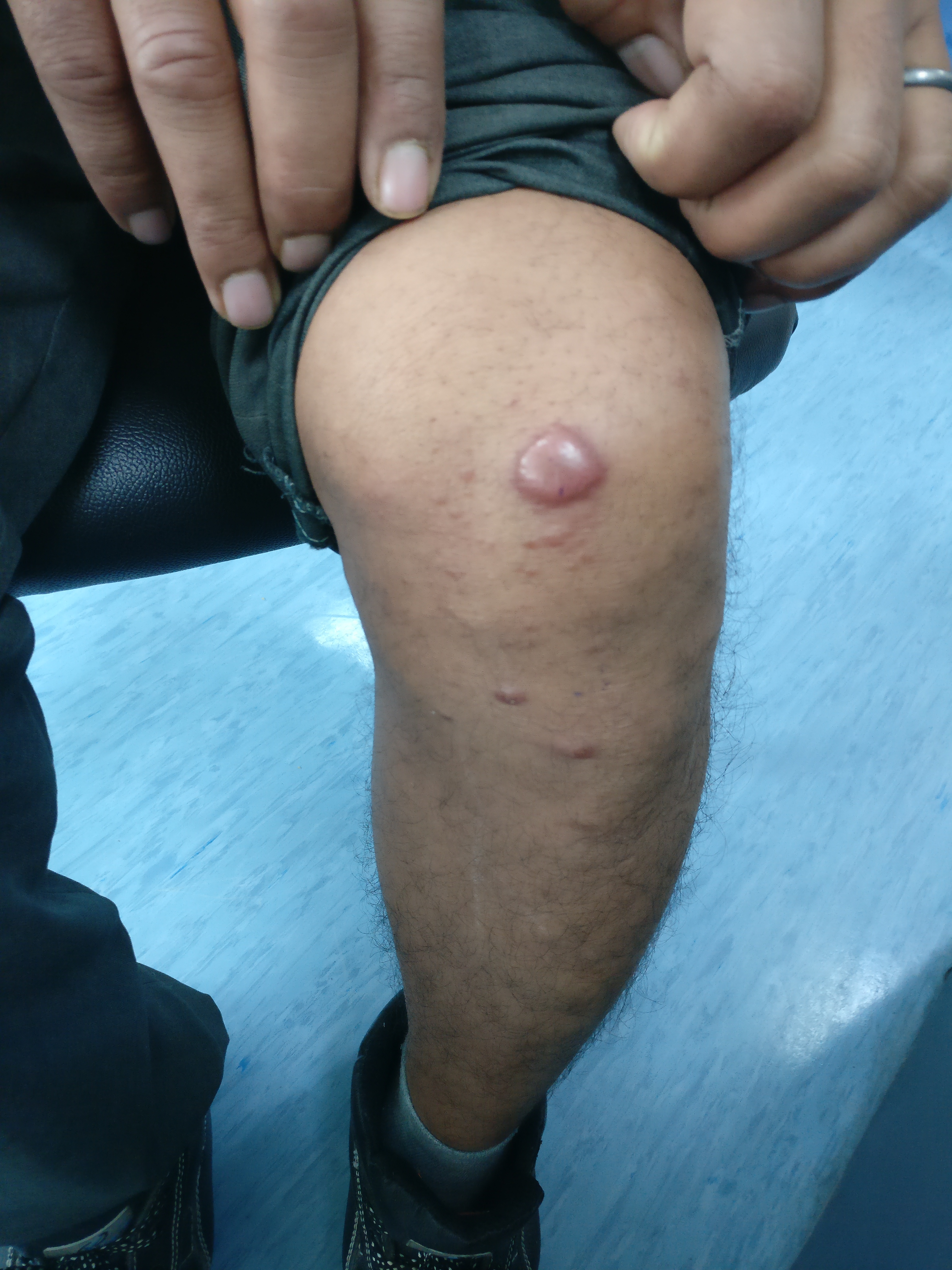 What Is The Differential Diagnosis For The Condition?