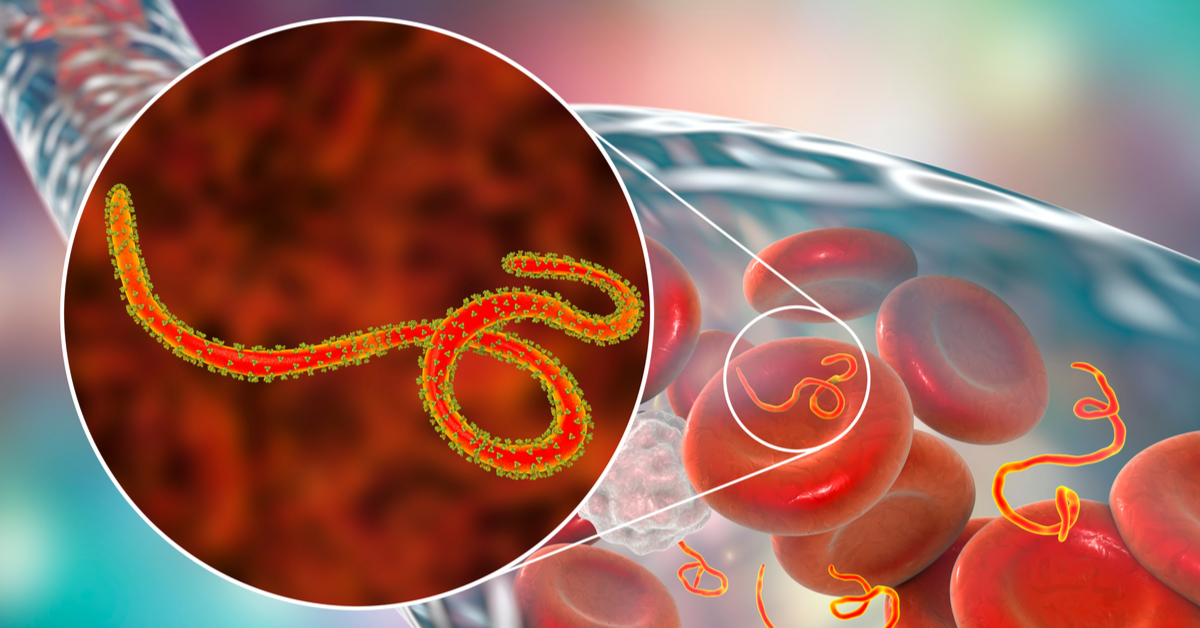 WHO Declares Ebola Outbreak In DR Congo A Global Health Emergency