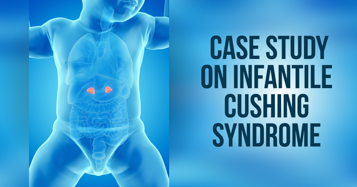 Infantile Cushing Syndrome due to Corticosteroids
