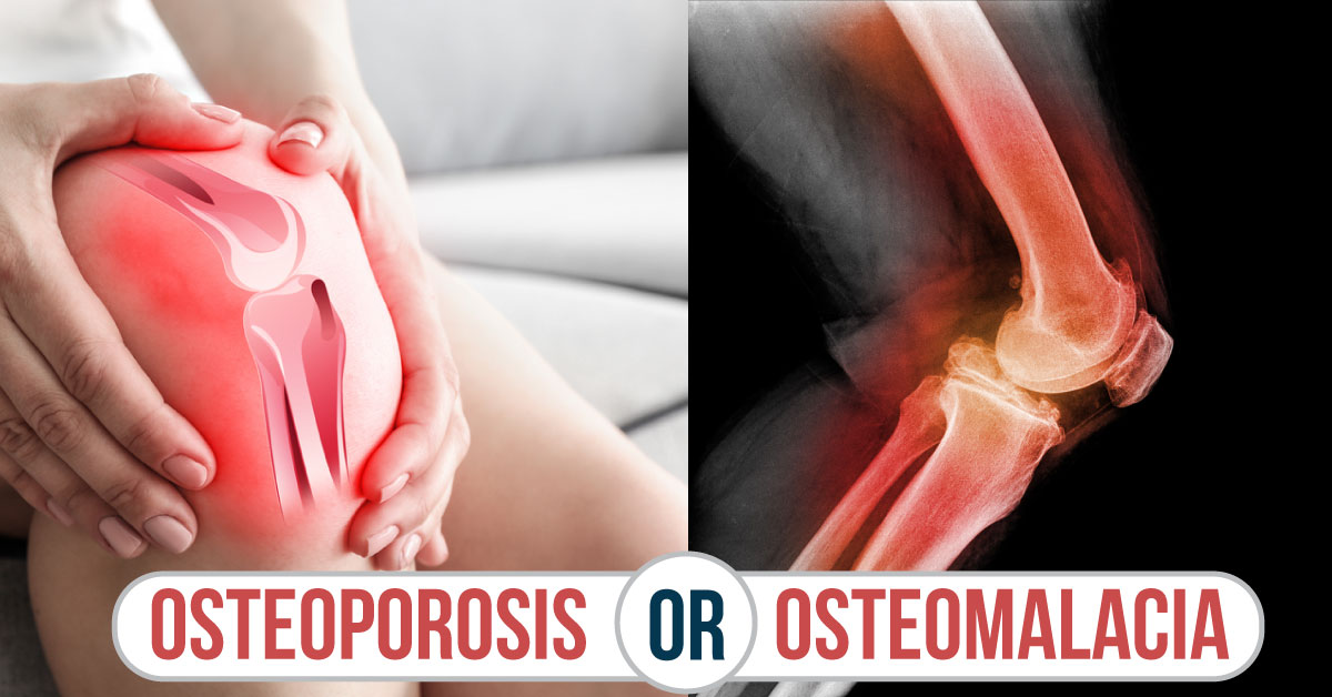 Not All Bone Related Issues Are Osteoporosis: A Case Of Osteomalacia