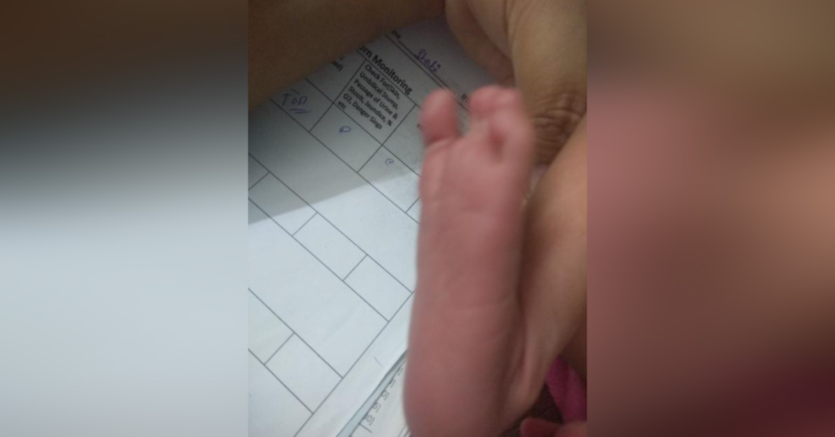 Slight Eversion Of Foot In Newborn
