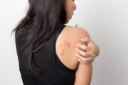 "Keto Rash" Commonly Seen In Models & Star Dieting Strictly Carbohydrates For Slim Appearance