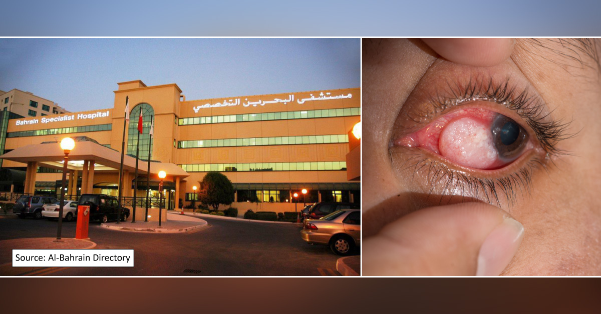 Bahrain Doctor Saves A Patient From Blindness Due To A Rare Ocular Tumor