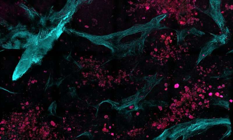 Multiphoton Microscopy A New Non Invasive Imaging Method Detect Cancer At Molecule Level