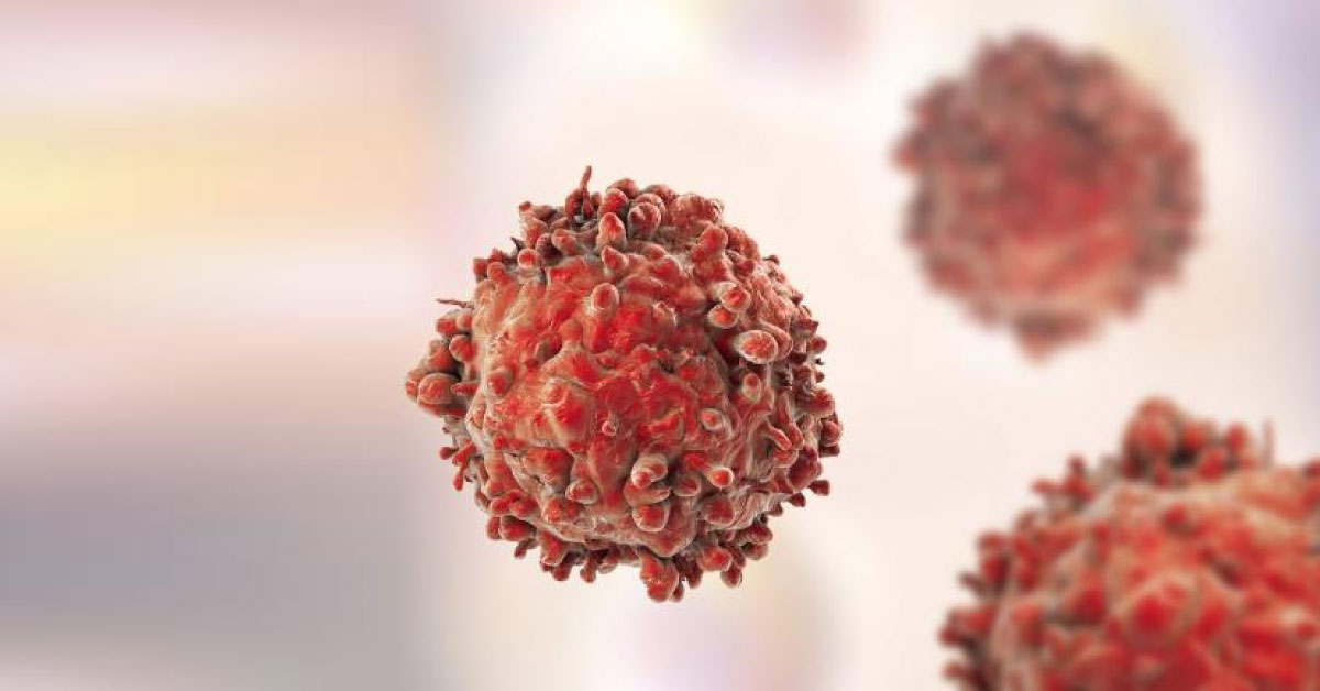 CAR-T Cell Therapy From Cancer Patient Own Blood Will Kill Cancer