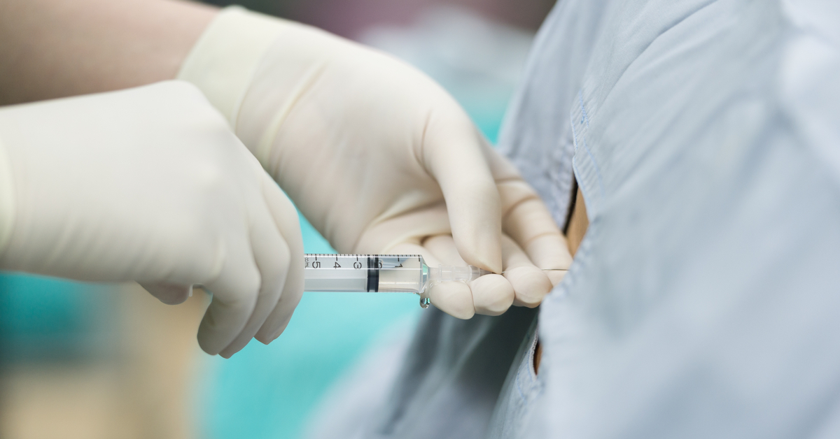 Misconceptions About Spinal Anaesthesia