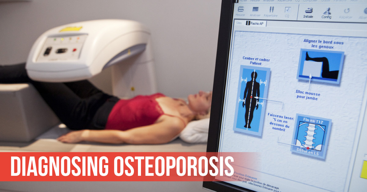 Predicting Risks of Osteoporosis