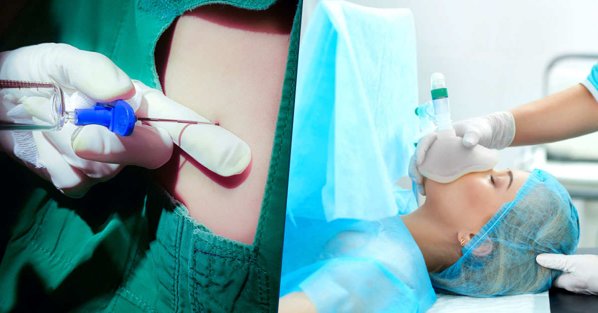 Public Awareness: Types of Anaesthesia