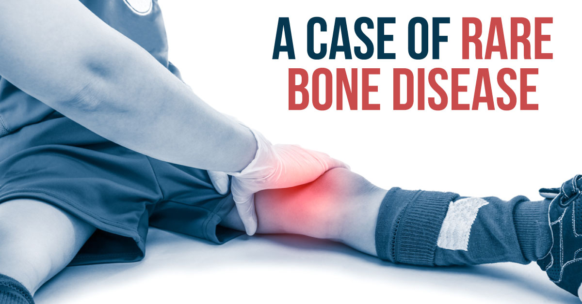 A Case of Distinct Sclerotic Lesions and Restricted Movements