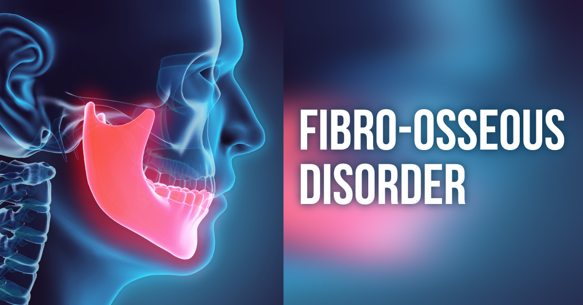 A Rare Case of Fibro-osseous Disorder