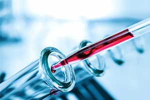 An Outbreak Of Crimean Congo Hemorrhagic Fever Recurs In Gujarat?