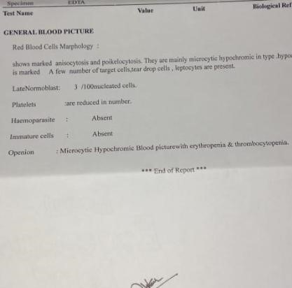 Bicytopenia In 16 Months Old