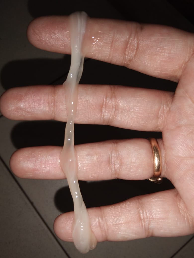 This Quotation After Passing First Urine