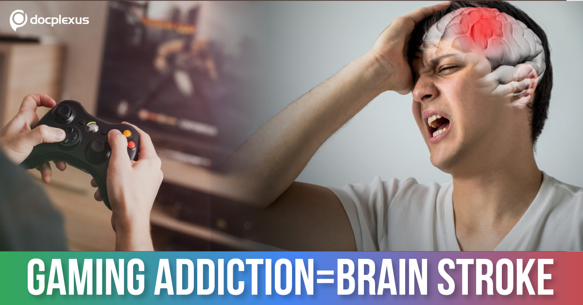 Gaming Addictions: A Growing Concern in Doctors