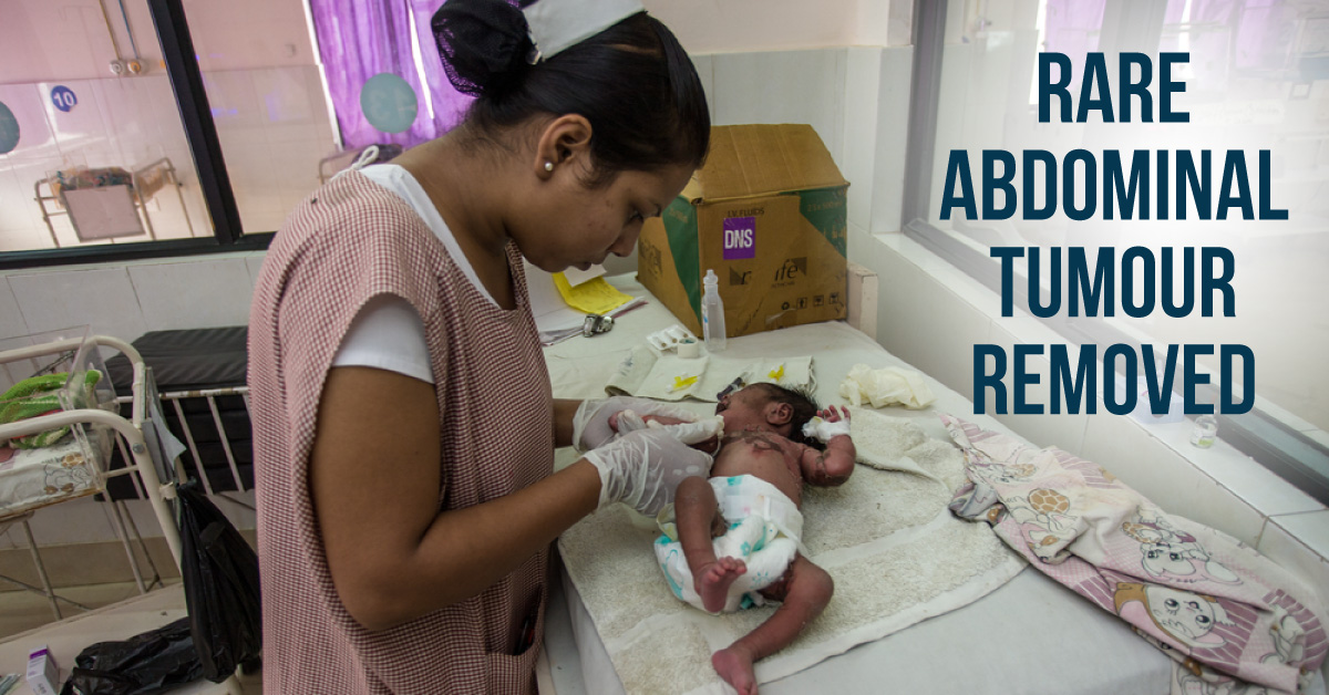 Rare Abdominal Tumour Operated Out Of A 7-Month-Old Baby