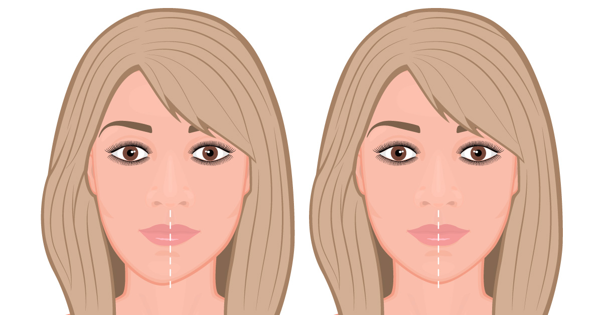 Facial Asymmetry Correction