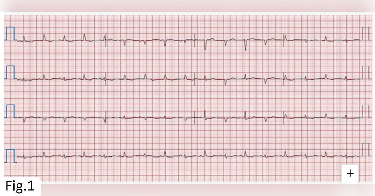 A Breast Cancer Patient with Progressive Shortness of Breath: Can You Manage the Case?