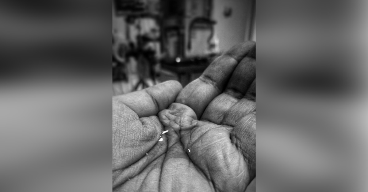 How 2 Milliliters Stops Your Suffering