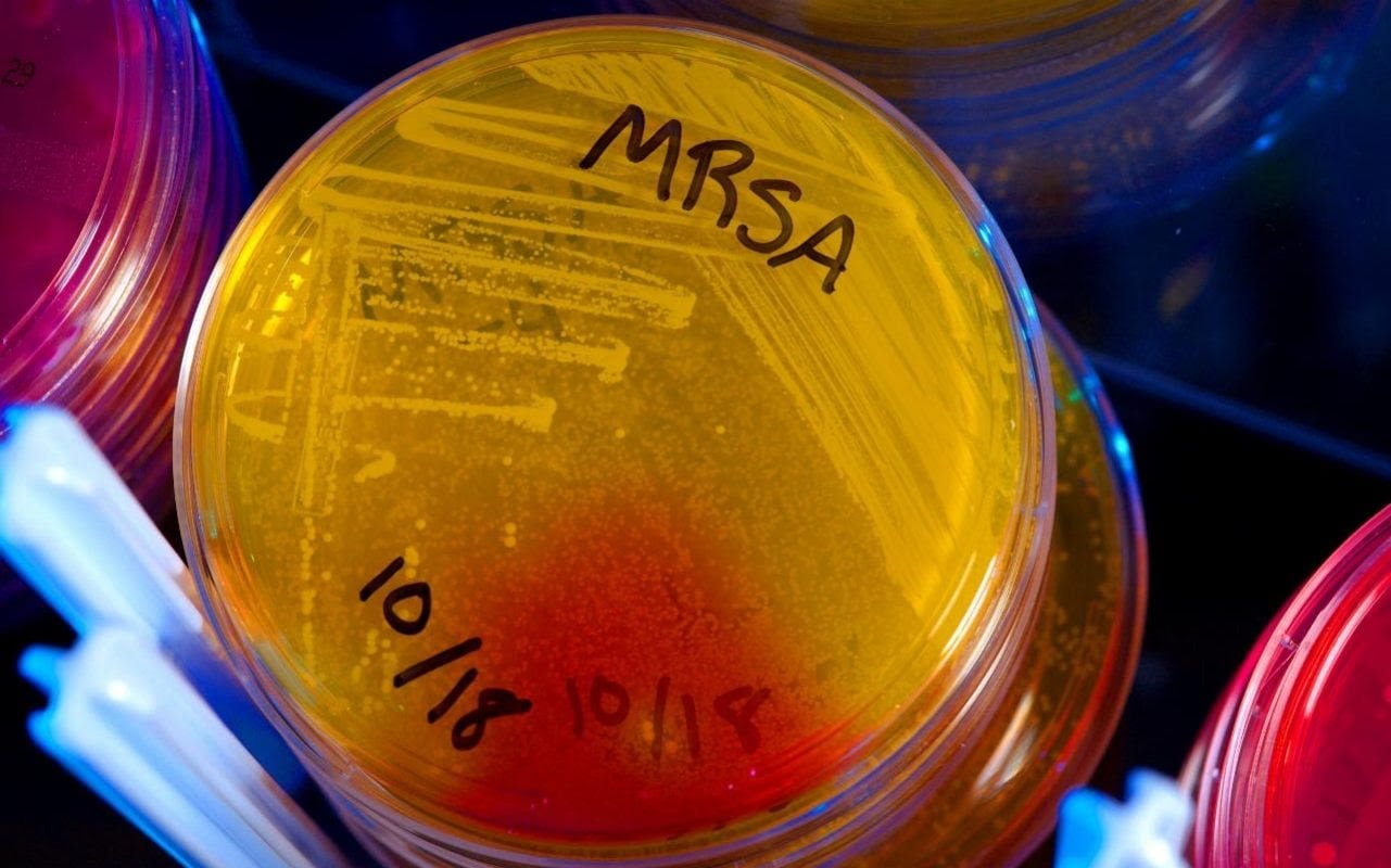 Life-saving Drugs May Soon Become Useless, Experts Warn As 19 Untreatable Superbugs Are Discovered In The Last Decade