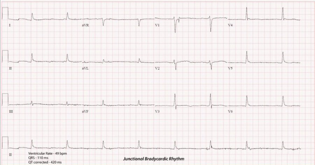Case of a Geriatric Patient with an Altered Mental Status