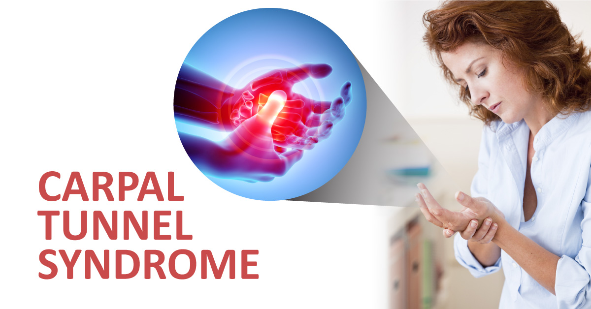 Carpal Tunnel Syndrome: Academy of Orthopaedic Physical Therapy Guidelines (2019)
