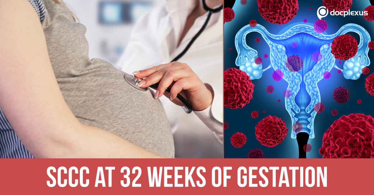 How Would You Treat SCCC In Later Stages Of Pregnancy