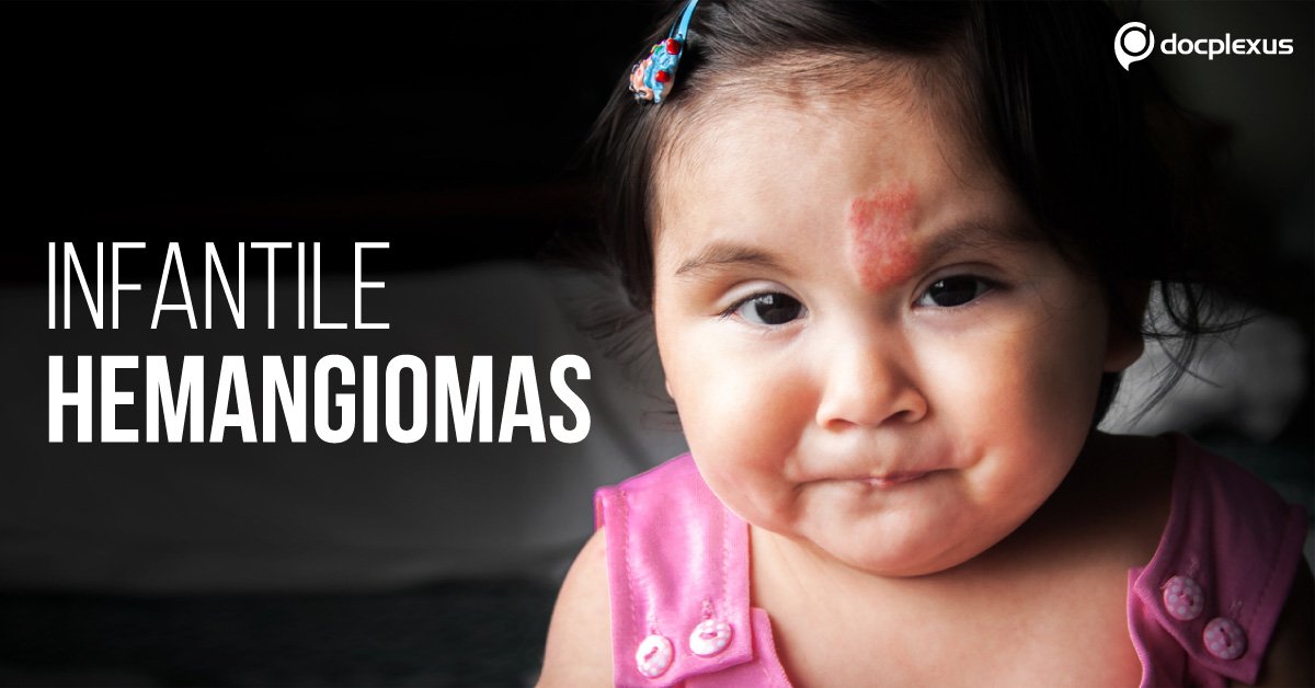 Infantile Hemangiomas : American Academy of Pediatrics Guidelines (2019)