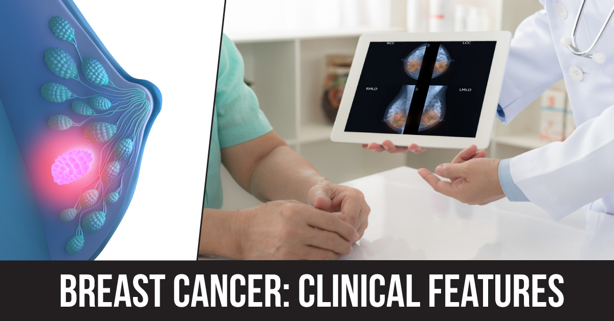 Clinical Presentation and Etiological Aspects of Breast Cancer