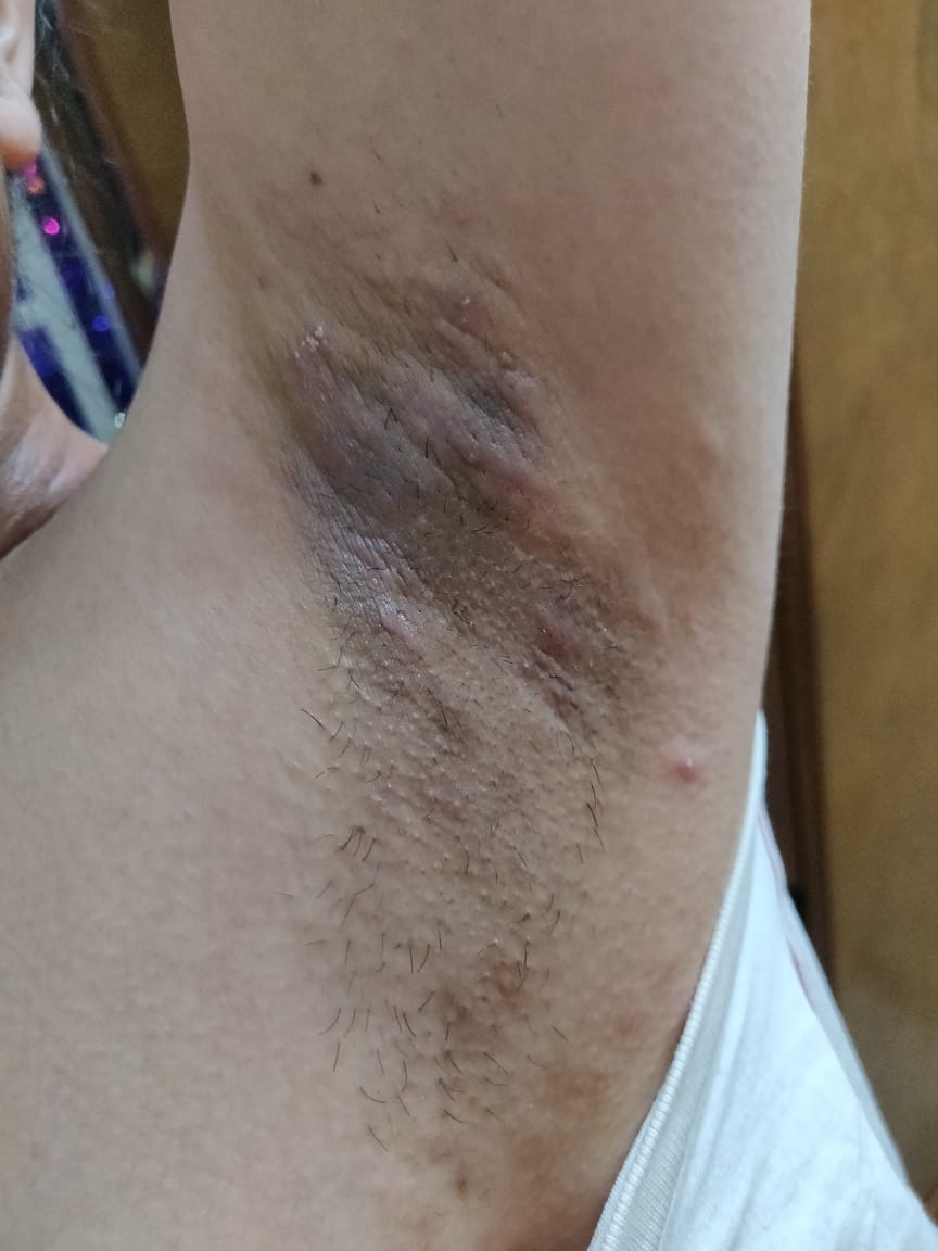 What Is This Problem To Young Lady?