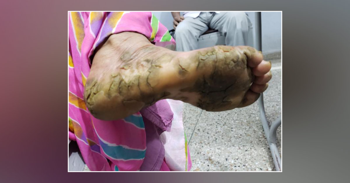 Is Rainy Season Responsible For This Problem?
