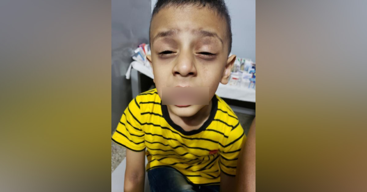 Is This A Syndrome ?