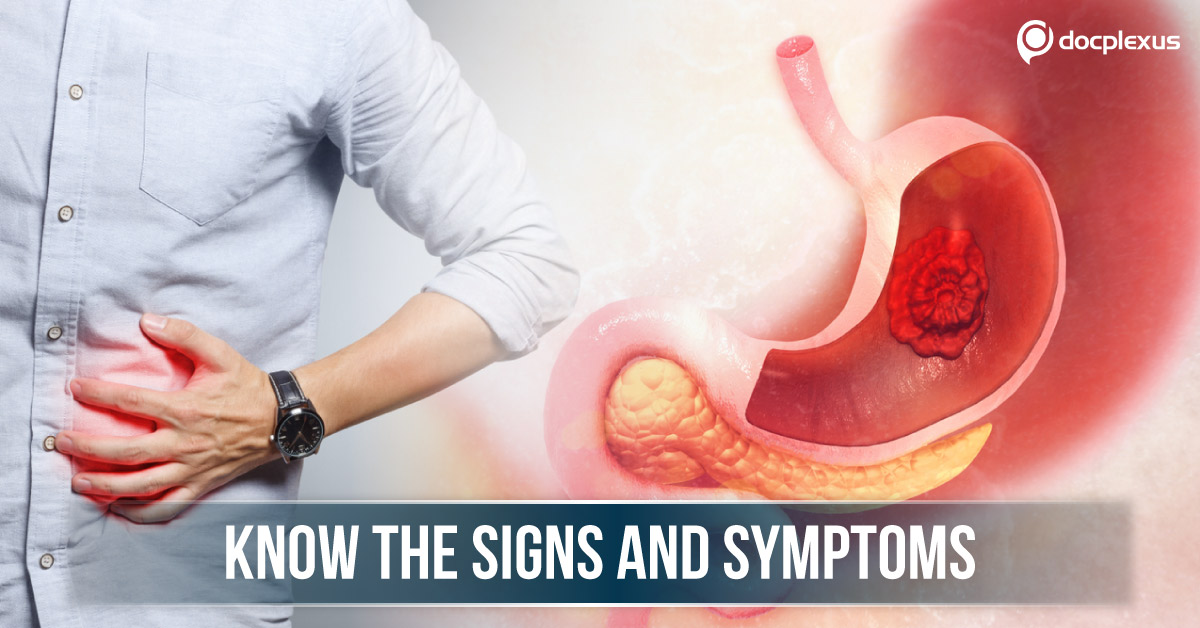 Clinical Presentations of Gastric Cancer