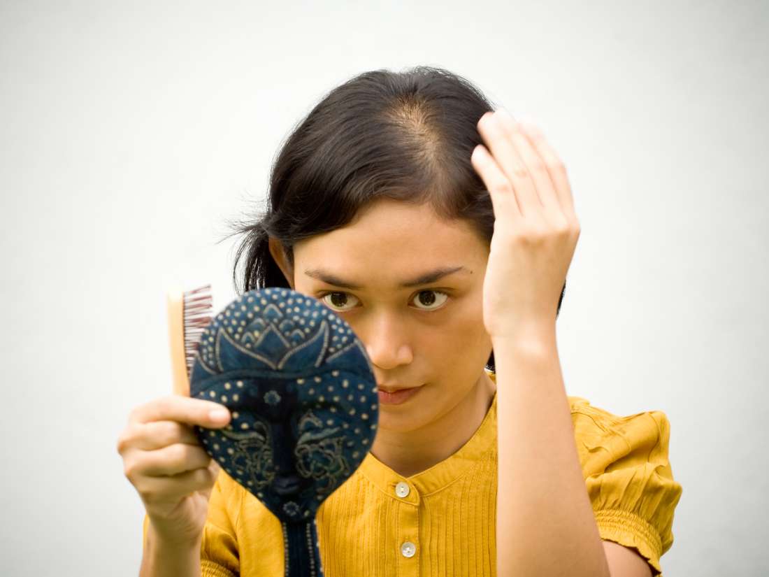 Baldness! How To Control It? Some Facts About Hair To Tackle It