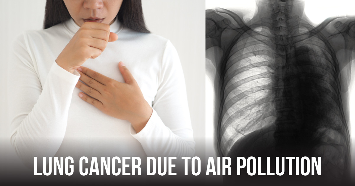 Non-smoker Women Diagnosed With Lung Cancer