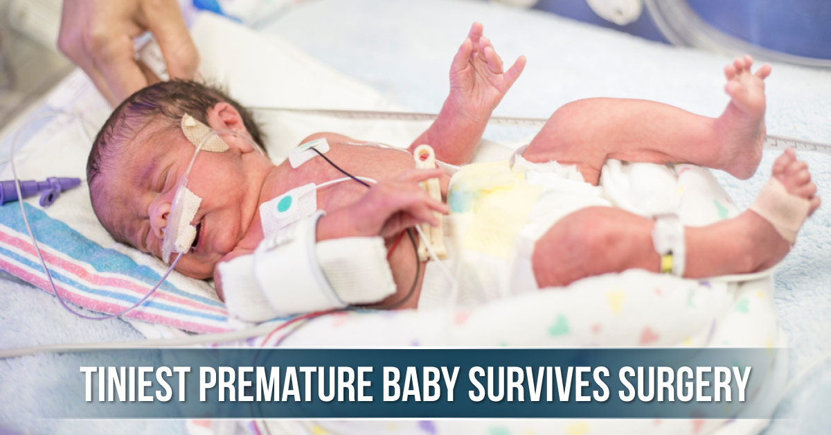 Tiniest Premature Baby Of UAE Survives Surgery