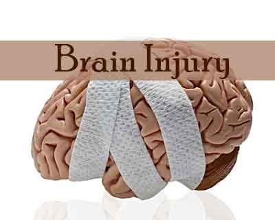 Tranexamic Acid May Reduce Head Injury Related Deaths Upto 20% Finds Lancet Study