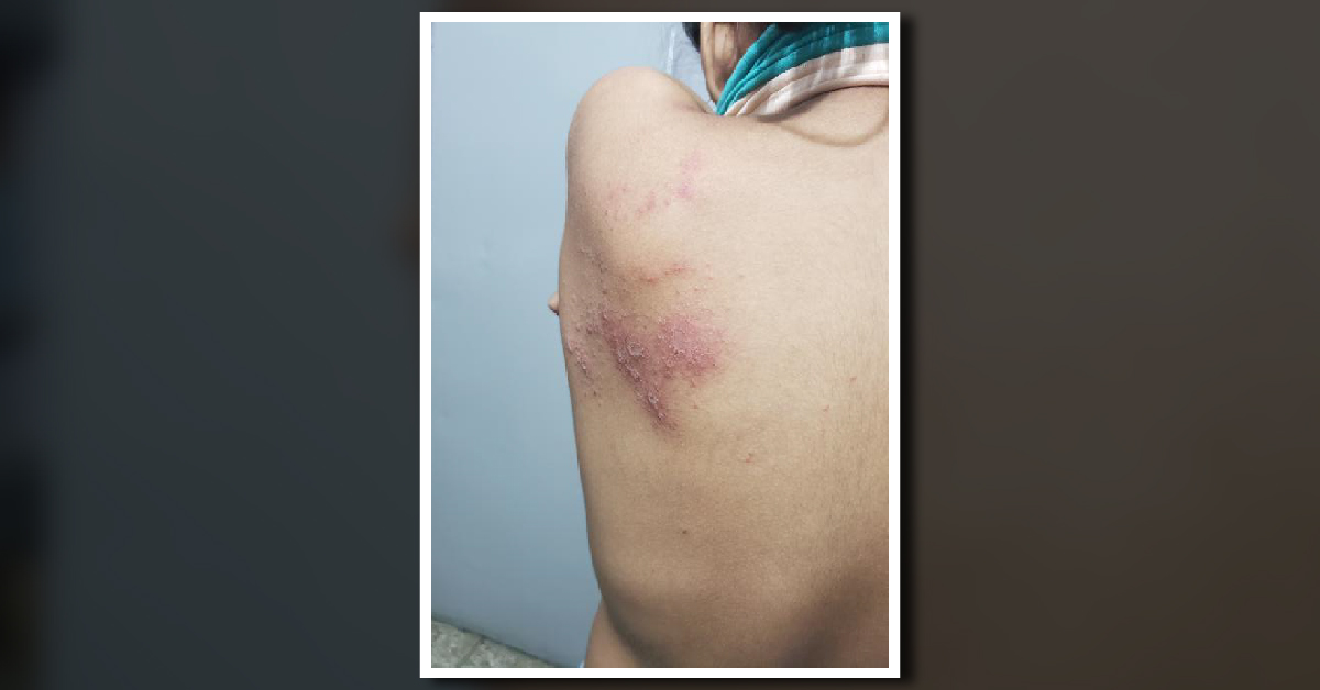 What Is This Skin Problem?
