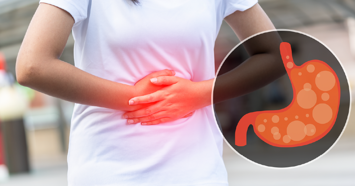 Inspite Using PPIs, Heart Burn, Regurgitation Not Controlled In Acidity Patients