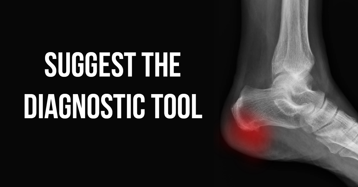 Suggest an Appropriate Diagnostic Technique for Diffuse Idiopathic Skeletal Hyperostosis