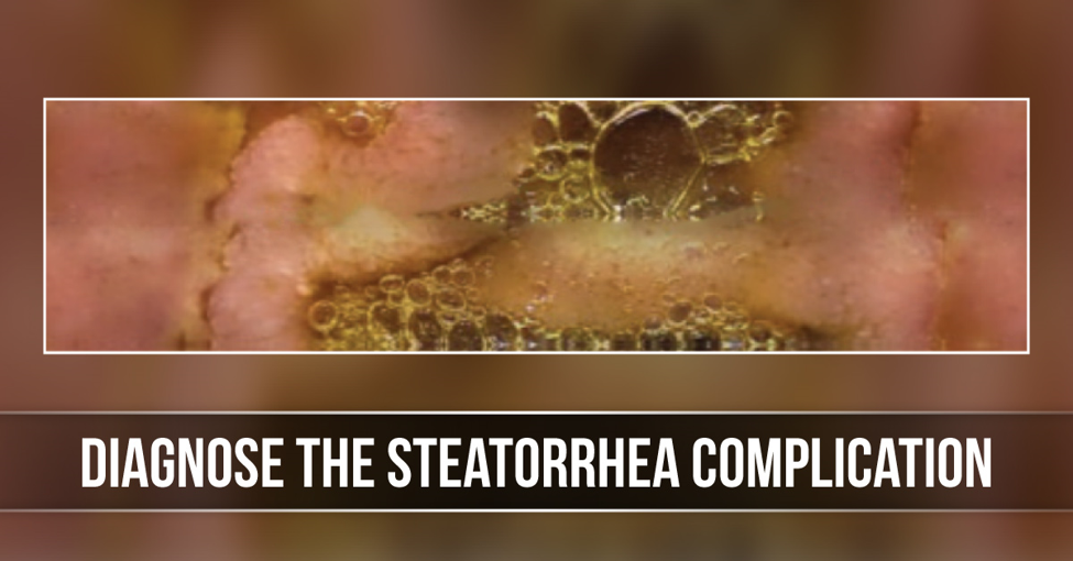 Diagnose This Steatorrhea Complication