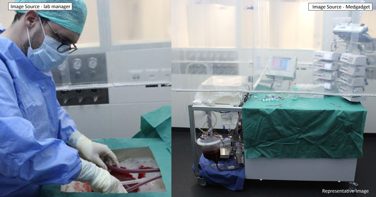 Unique Perfusion System Keeps Liver Alive For A Week
