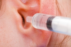 What Is The Best Way To Remove Ear Wax?