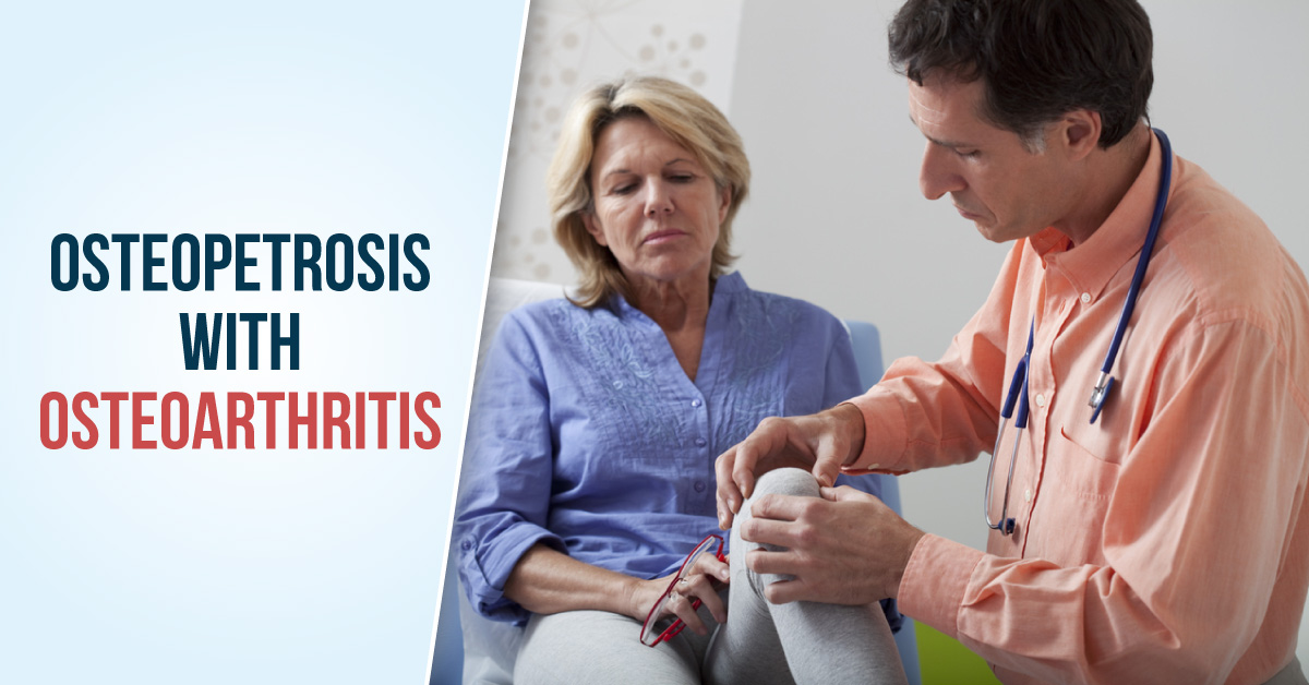 Crouching Osteopetrosis Hidden Osteoarthritis