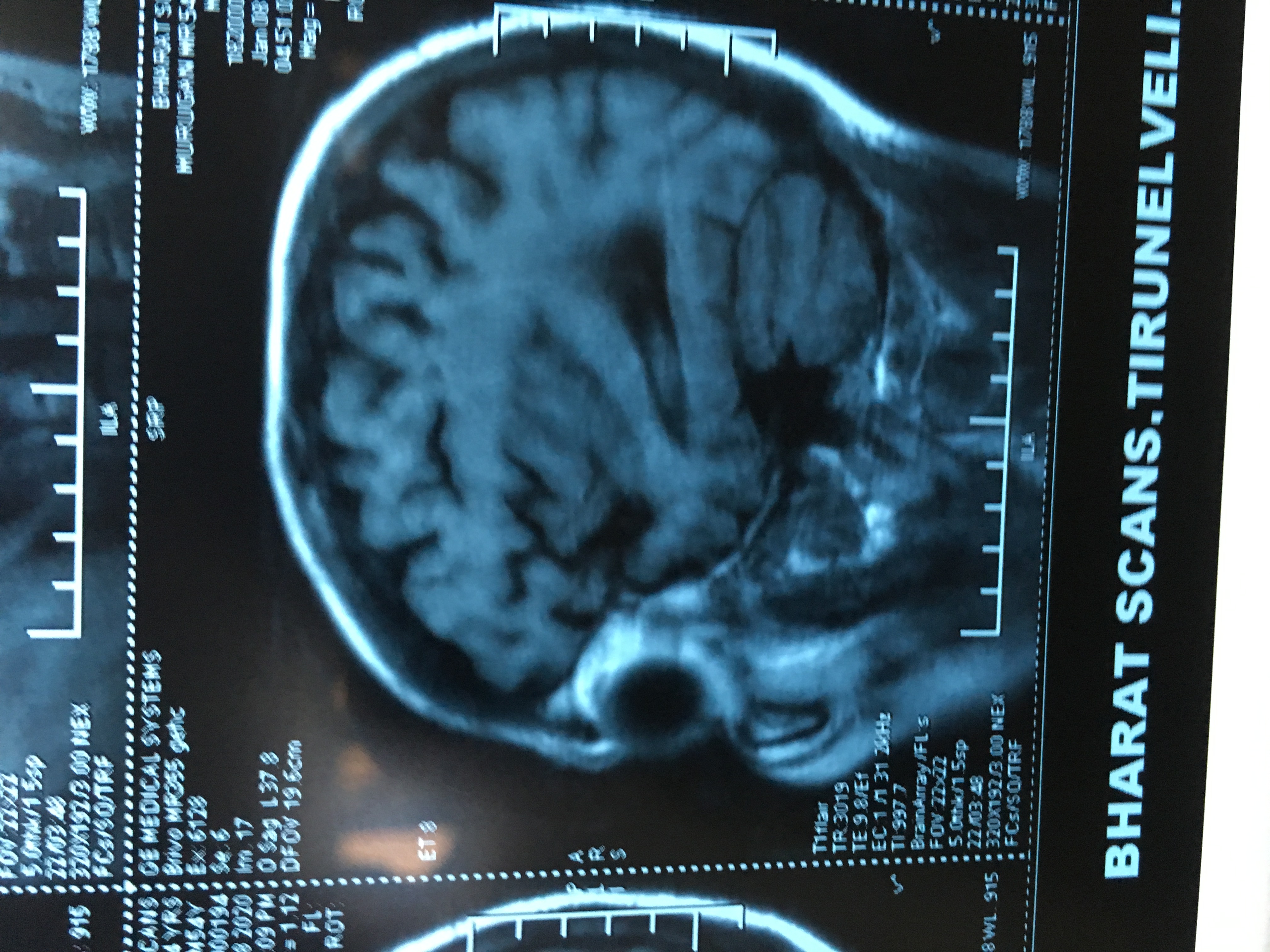 MRI Reporting Needs More Concentration