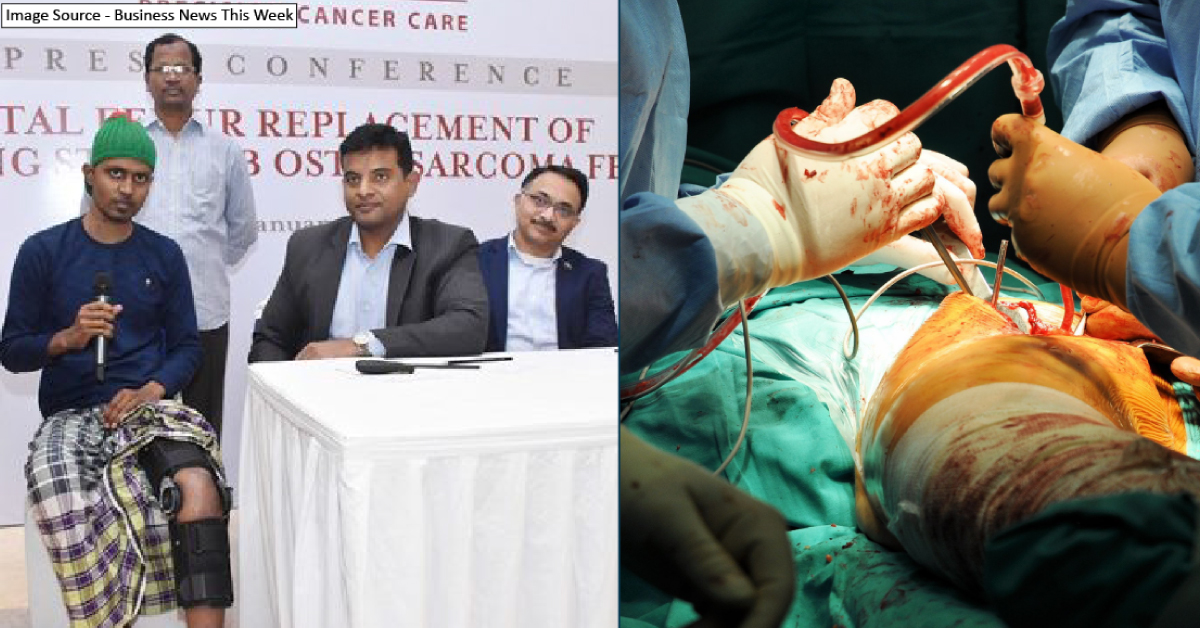 Indian Doctors Sucessfully Perform TFR Surgery